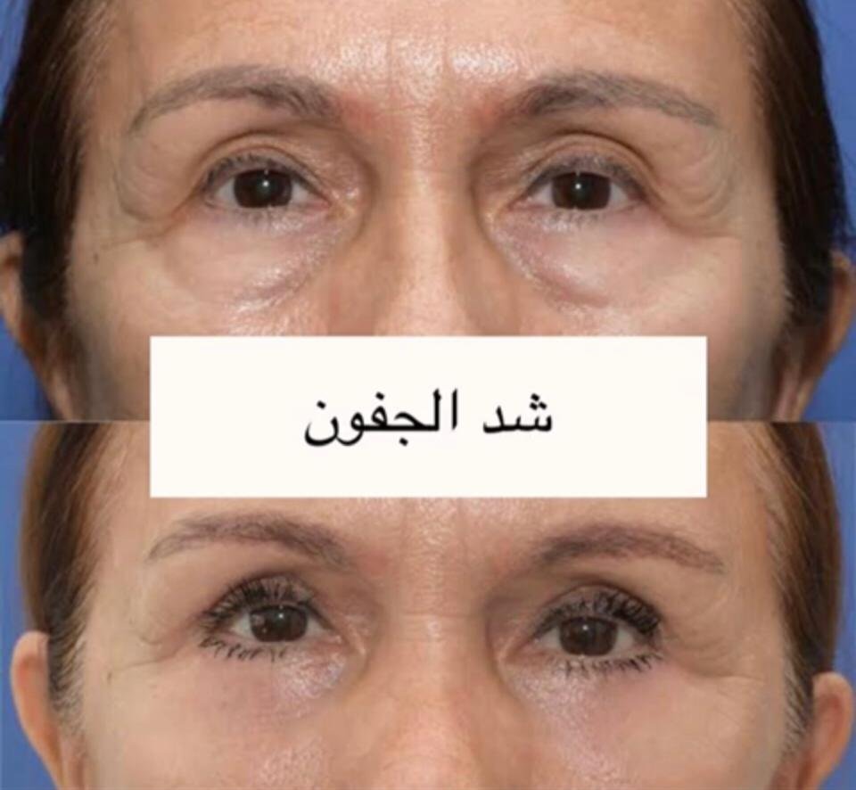 WhatsApp Image 2025-03-17 at 15.11.25_bcd3939a