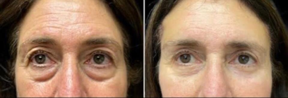 WhatsApp Image 2025-03-17 at 15.11.26_5d76521f