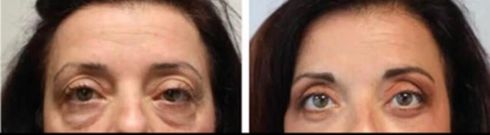 WhatsApp Image 2025-03-17 at 15.11.28_7d71aadf